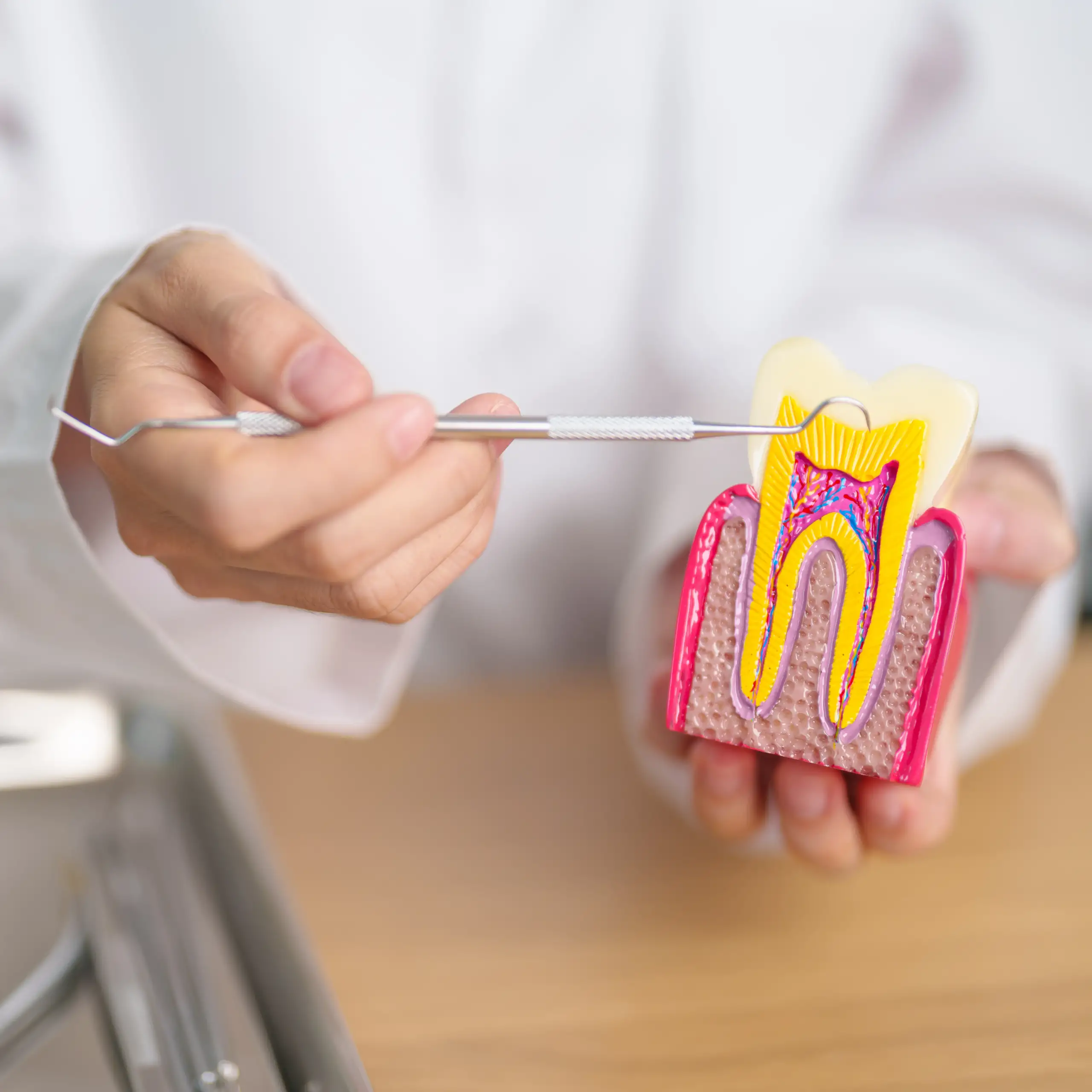 Smart Amalgam Sökümü 